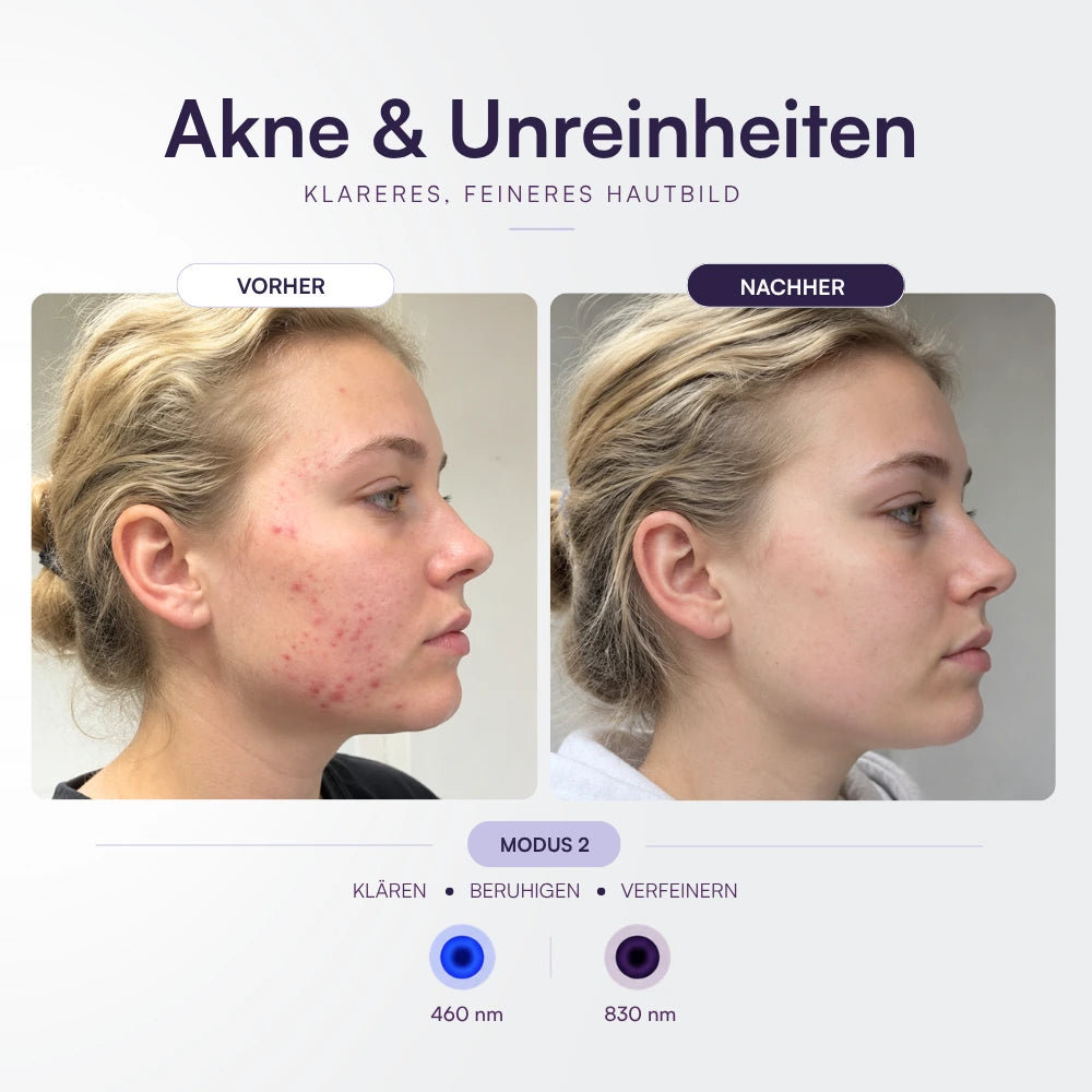 Koanna® MultiGlo™ LED Lichttherapie-Maske