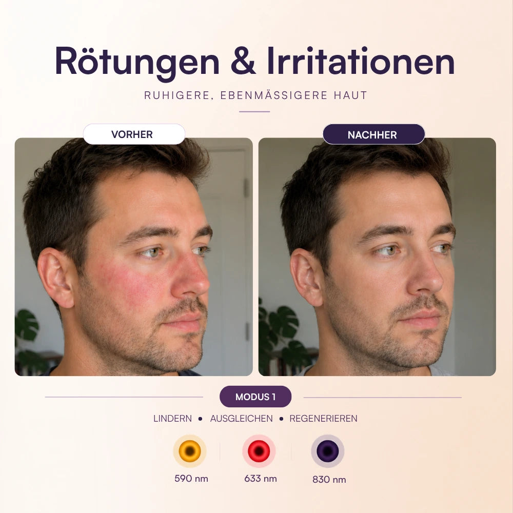 Koanna® MultiGlo™ LED Lichttherapie-Maske