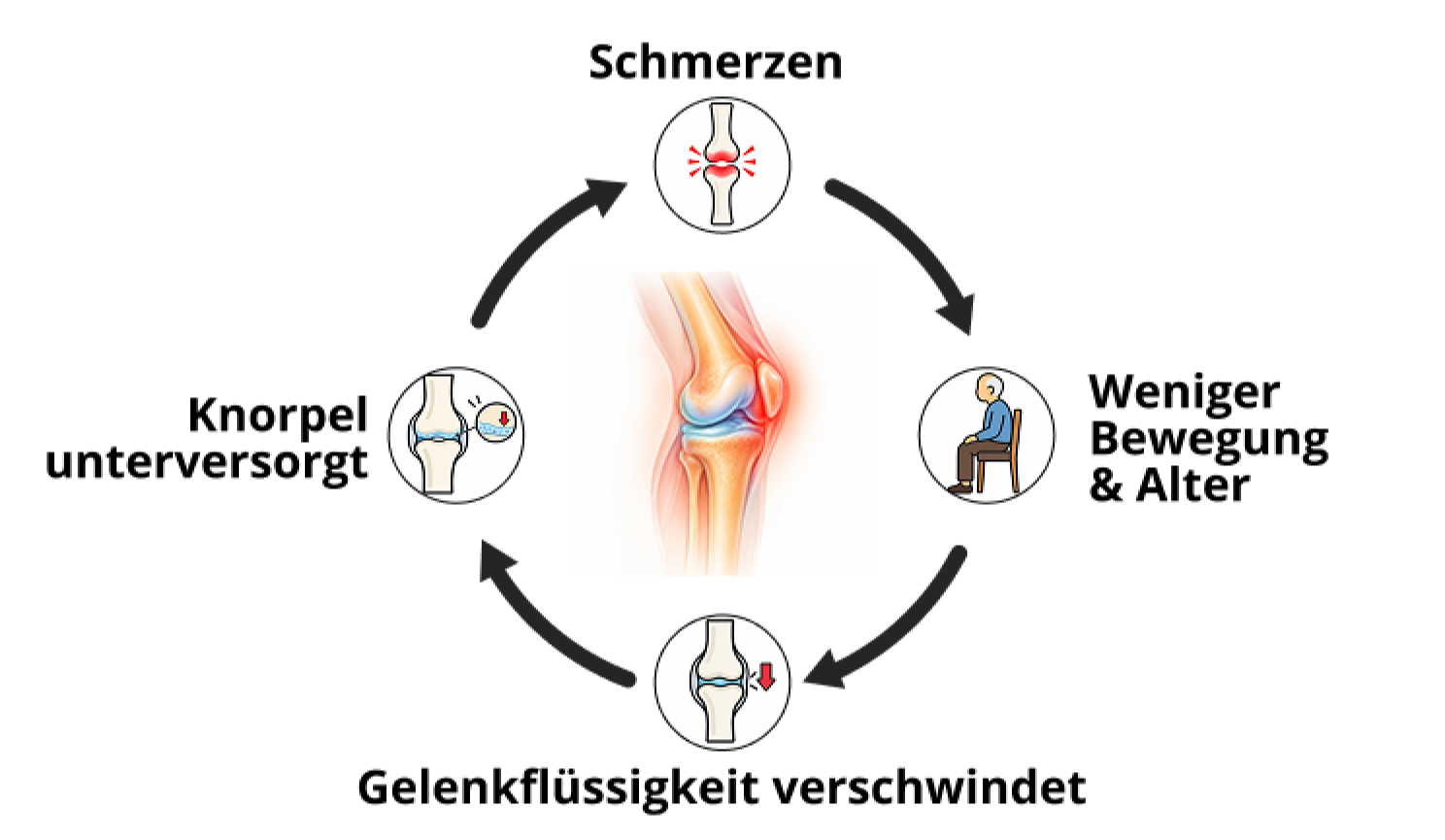 Kreislauf-Diagramm: Schmerzen, weniger Bewegung, Gelenkflüssigkeit verschwindet, Knorpel unterversorgt